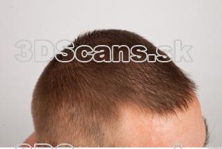 Hair texture of Gene 0002
